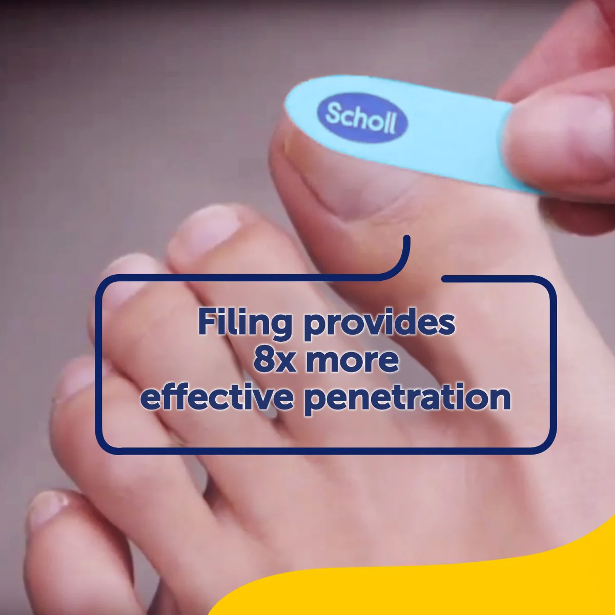 Fungal Nail Treatment - Image 6
